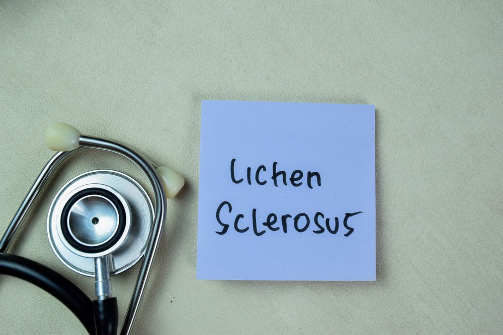 Lichen Sclerosus Frederick MD