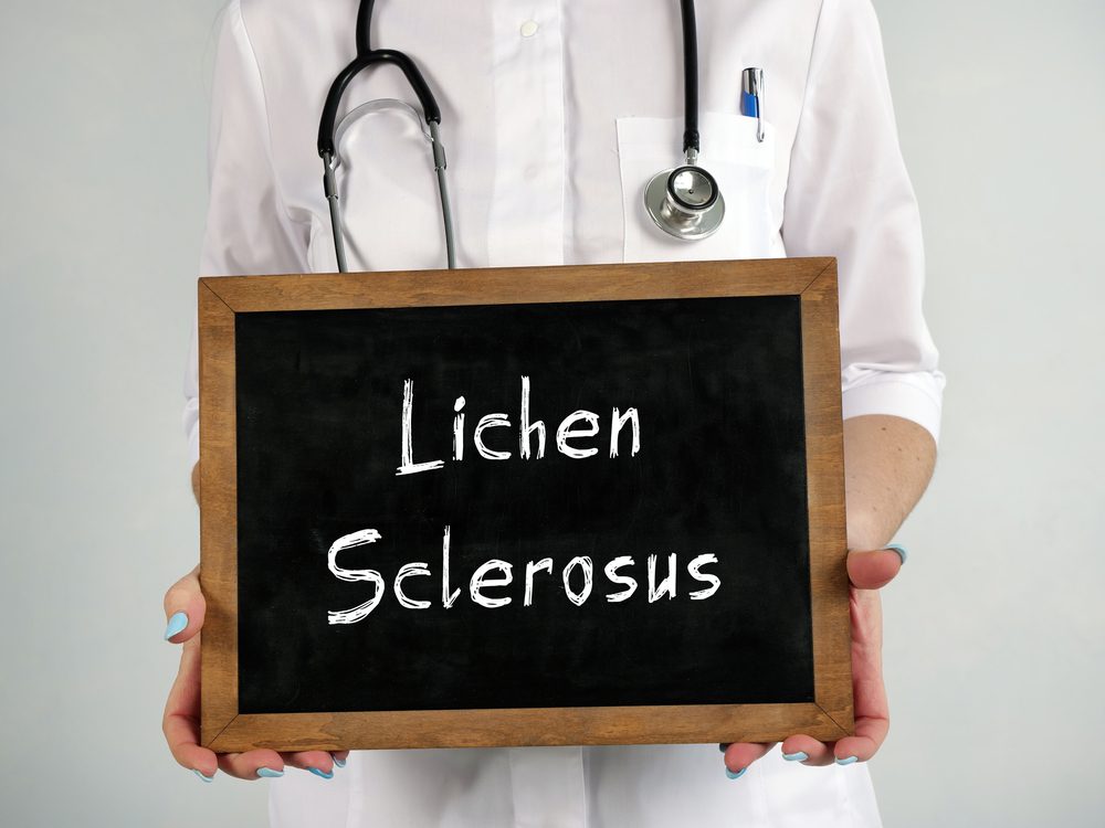 Lichen Sclerosus Specialist Treatment in Frederick County MD