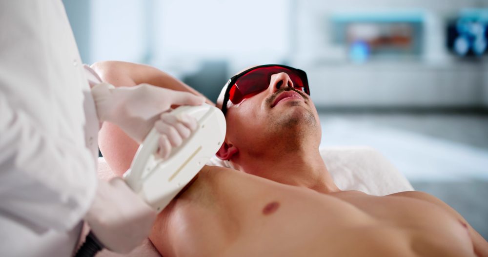 Laser Hair Removal for Men