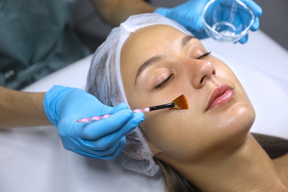 Chemical Peels and Microneedling Near Frederick, Maryland