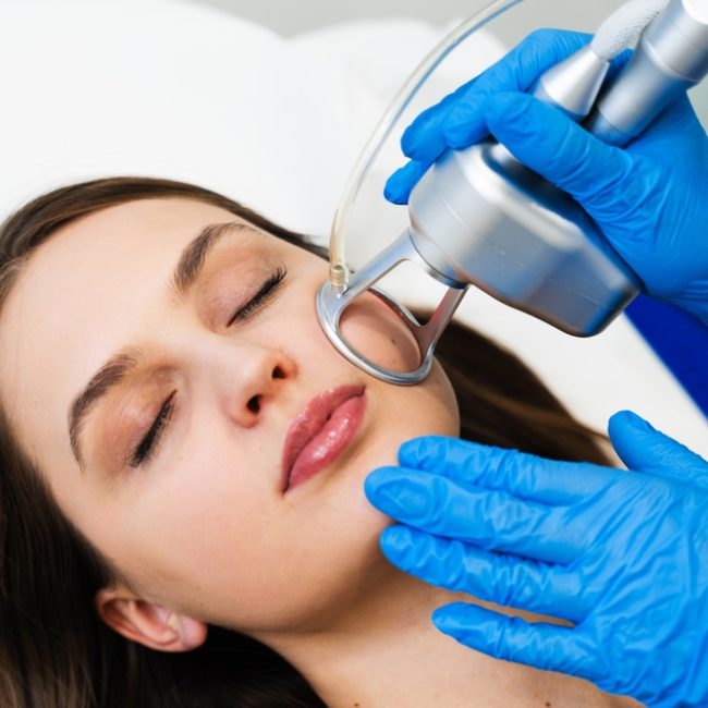 CO2 Laser Resurfacing Near Urbana MD