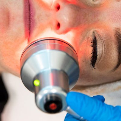 HydraFacial-0739