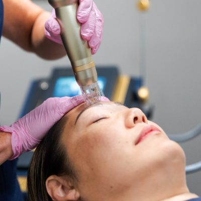Transformed Aesthetic & Wellness - Sylfirm X Microneedling-_ANO1238